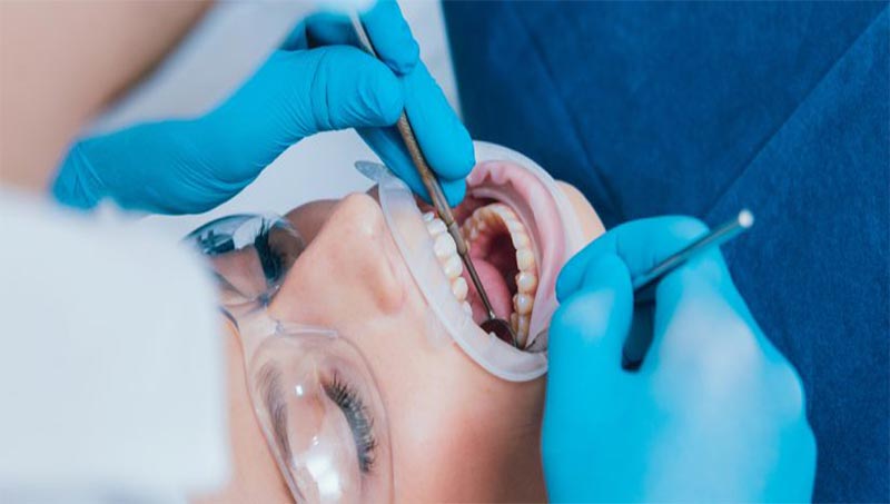 5 Effective Tips for Recovery After Root Canal Treatment