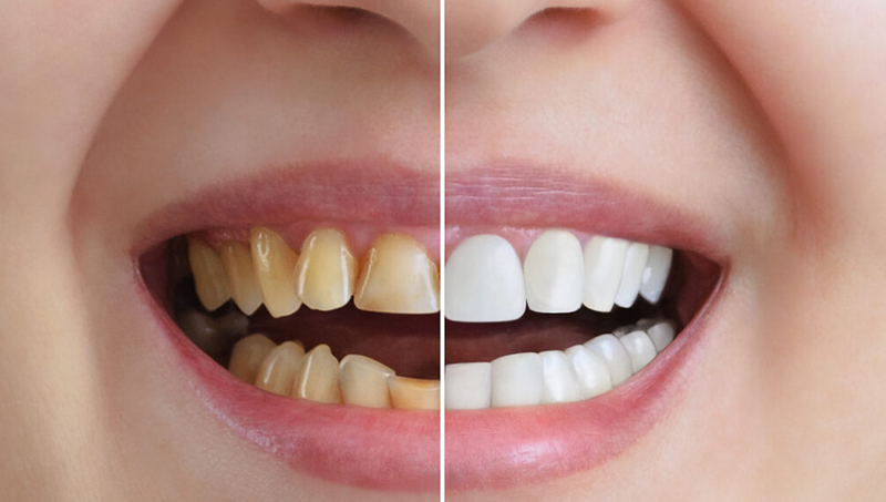 Best Dental Clinic in Vesu
