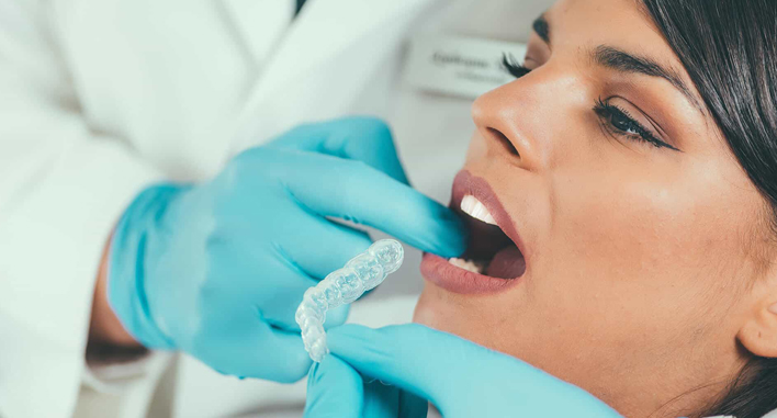 Cosmetic dentistry in Vesu