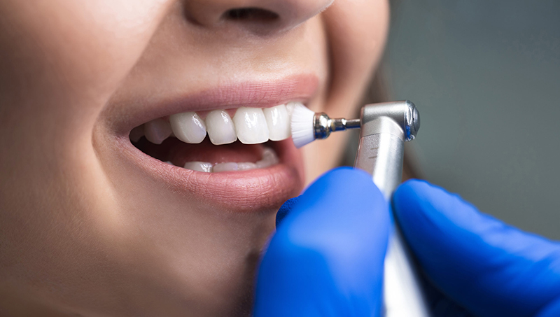 Why Do You Need Regular Teeth Cleanings?