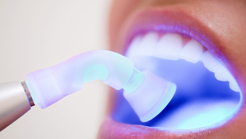 The Importance of Screening for Oral Cancer During Dental Exams