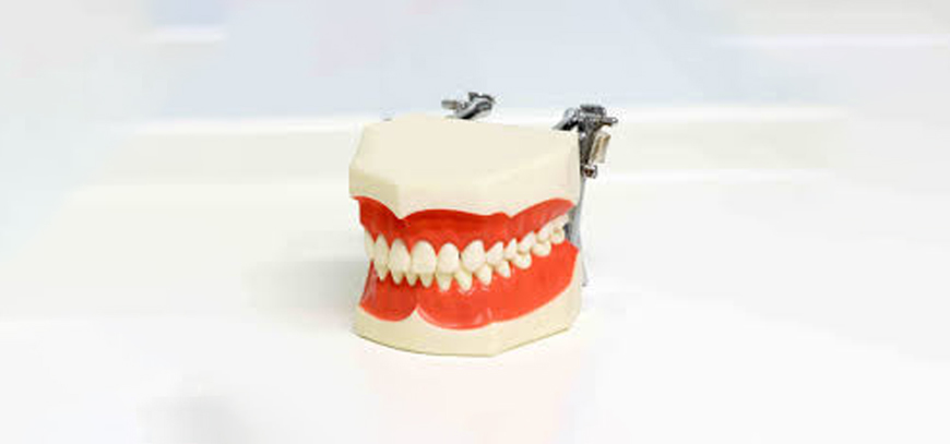 Full Mouth Rehabilitation