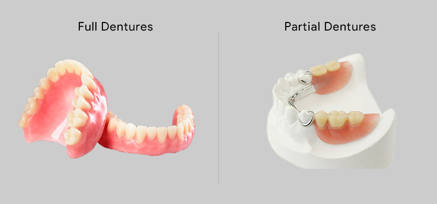 Complete / Partial Dentures