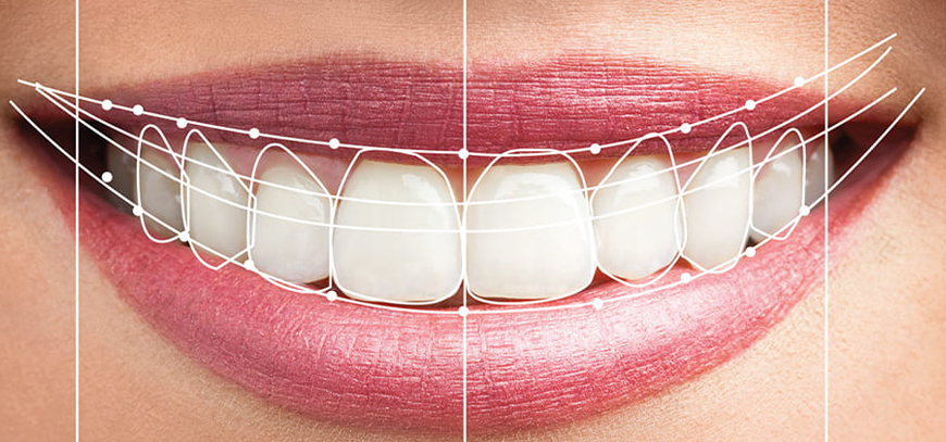 Digital Smile Design