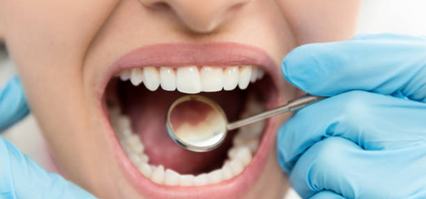 Multiple Tooth Implants
