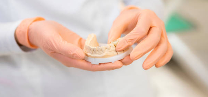 Implant Retained Dentures
