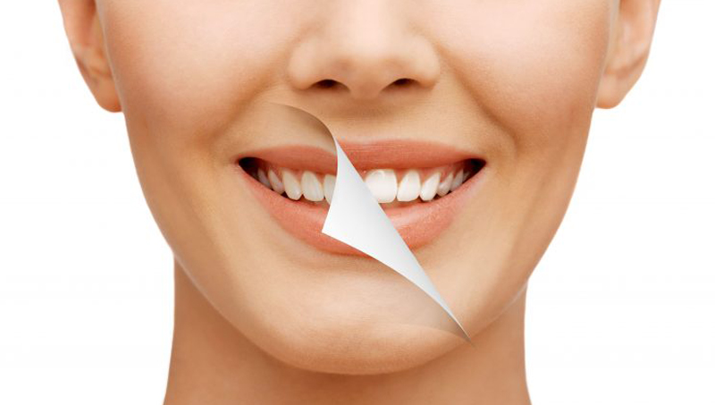 Laser Dentistry: The New Way to Treat the Smile